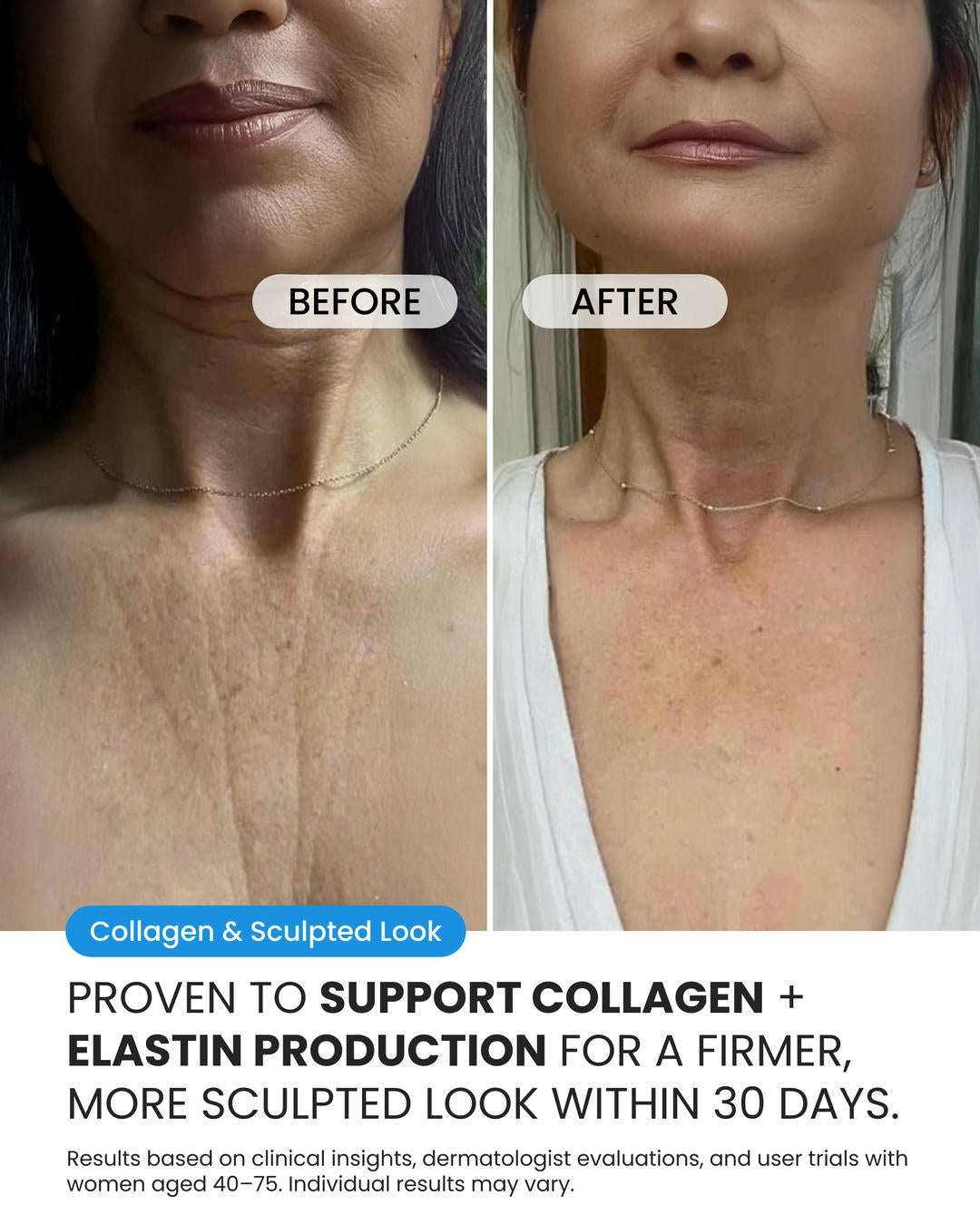 Neck Cream