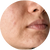 Uneven Skin Tone menu image